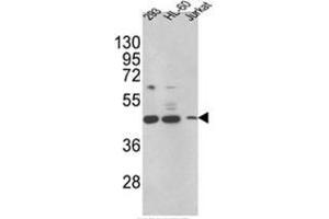 Western blot analysis of HSD17B7 Antibody (HSD17B7 anticorps  (N-Term))