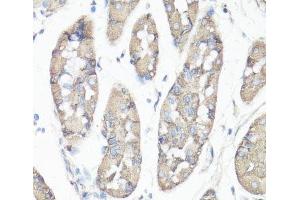Immunohistochemistry of paraffin-embedded Human stomach using FAK Polyclonal Antibody at dilution of 1:100 (40x lens). (FAK anticorps)