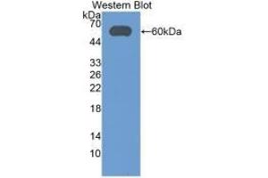 Detection of Recombinant ALDH7A1, Human using Monoclonal Antibody to Aldehyde Dehydrogenase 7 Family, Member A1 (ALDH7A1) (ALDH7A1 anticorps  (AA 1-539))