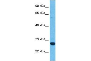 Host:  Rabbit  Target Name:  HPGDS  Sample Tissue:  Human Ovary Tumor  Antibody Dilution:  1ug/ml