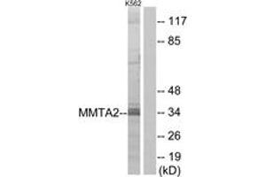 Western blot analysis of extracts from K562 cells, using MMTAG2 Antibody. (C1orf35 anticorps  (AA 10-59))