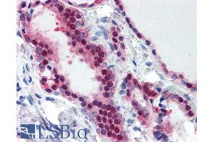 anti-TIA1 Cytotoxic Granule-Associated RNA Binding Protein (TIA1) (Internal Region) antibody