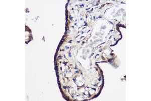 Immunohistochemistry of paraffin-embedded Human placenta using LRRK2 Rabbit pAb  at dilution of 1:100 (40x lens). (LRRK2 anticorps  (AA 2355-2527))