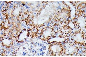 Immunohistochemistry of paraffin-embedded Mouse kidney using IDH3A Polyclonal Antibody at dilution of 1:100 (40x lens).