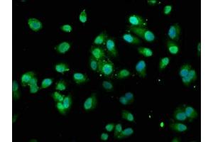 Immunofluorescence staining of Hela cells with ABIN7172014 at 1:100, counter-stained with DAPI.