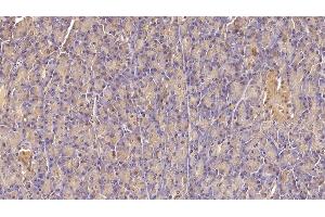 Detection of INSR in Human Pancreas Tissue using Monoclonal Antibody to Insulin Receptor (INSR)