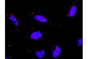 Proximity Ligation Analysis of protein-protein interactions between HSPA1L and TP53.