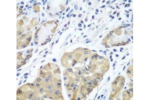 Immunohistochemistry of paraffin-embedded Human stomach using PLCB2 Polyclonal Antibody at dilution of 1:100 (40x lens).