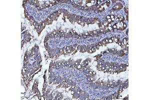 IHC analysis of LI Cadherin/CDH17 using anti-LI Cadherin/CDH17 antibody (ABIN7600855). (LI Cadherin anticorps  (AA 24-695))