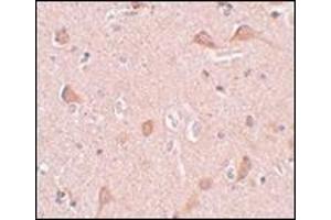 Immunohistochemistry of SIPA1L1 in human brain tissue with this product at 5 μg/ml. (SIPA1L1 anticorps  (N-Term))