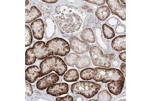 Immunohistochemical staining of human kidney with ABLIM2 polyclonal antibody  shows strong cytoplasmic positivity in cells of tubules. (ABLIM2 anticorps)