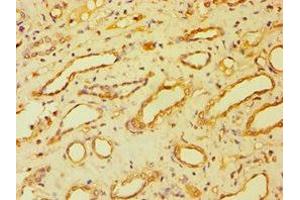 anti-Bartter Syndrome, Infantile, with Sensorineural Deafness (Barttin) (BSND) (AA 54-320) antibody