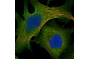 Immunofluorescent staining of human cell line U-2 OS shows positivity in nucleoli, plasma membrane & cytoplasm. (Myosin X anticorps)