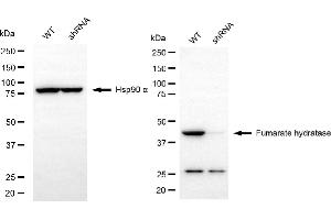 Western blotting analysis using fumarate hydratase antibody (ABIN7798663).