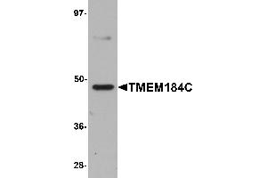 Western Blotting (WB) image for anti-Transmembrane Protein 184C (TMEM184C) (C-Term) antibody (ABIN1030749) (TMEM184C anticorps  (C-Term))