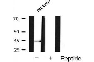 Western blot analysis of extracts of Rat liver lysates,using Phospho-Cyclin D1 (Ser90) Antibody . (Cyclin D1 anticorps  (pSer90))
