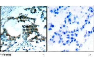 Image no. 1 for anti-Protein Kinase C, theta (PRKCQ) (pSer695) antibody (ABIN196902) (PKC theta anticorps  (pSer695))