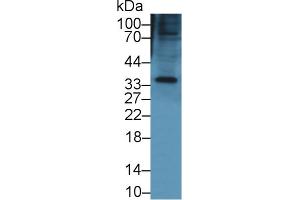 Western Blot; Sample: Mouse Small intestine lysate; Primary Ab: 1µg/ml Rabbit Anti-Mouse KERA Antibody Second Ab: 0. (KERA anticorps  (AA 21-292))