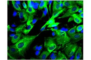 Immunofluorescence (IF) image for anti-Adaptor-Related Protein Complex 2, beta 1 Subunit (AP2B1) (AA 75-245) antibody (ABIN967931)