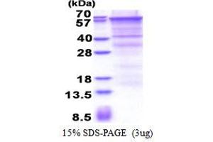SDS-PAGE (SDS) image for Endoglin (ENG) (AA 26-586) protein (His tag) (ABIN6387366) (Endoglin Protein (ENG) (AA 26-586) (His tag))