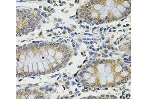 Immunohistochemistry of paraffin-embedded Human colon using DDX20 Polyclonal Antibody at dilution of 1:100 (40x lens). (DDX20 anticorps)