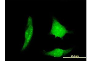 Immunofluorescence of monoclonal antibody to RCAN1 on HeLa cell. (RCAN1 anticorps  (AA 1-100))