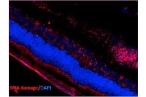 Immunohistochemistry analysis using Mouse Anti-DNA Damage Monoclonal Antibody, Clone 15A3 (ABIN361743 and ABIN361744). (DNA Damage anticorps)