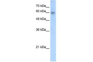 WB Suggested Anti-RCOR2 Antibody Titration:  5. (Rcor2 anticorps  (N-Term))