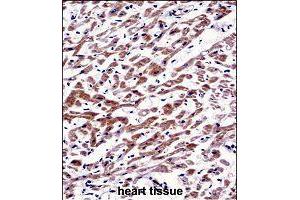 Immunohistochemistry (Formalin/PFA-fixed paraffin-embedded sections) of human heart tissue with MOV10 polyclonal antibody  followed by peroxidase conjugation of the secondary antibody and DAB staining. (MOV10 anticorps  (AA 260-288))