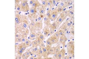 Immunohistochemistry of paraffin-embedded human liver injury using TXNRD2 antibody.
