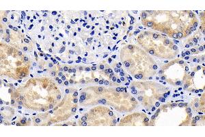 Detection of CASP9 in Human Kidney Tissue using Polyclonal Antibody to Caspase 9 (CASP9)