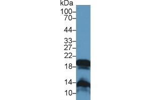 Detection of GKN2 in Rat Stomach lysate using Polyclonal Antibody to Gastrokine 2 (GKN2) (Gastrokine 2 anticorps  (AA 21-184))