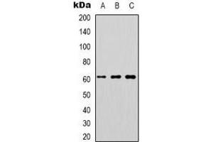 Western blot analysis of DOK1 expression in K562 (A), Jurkat (B), RAW264. (DOK1 anticorps)