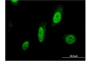 Immunofluorescence of monoclonal antibody to BIRC7 on HeLa cell. (BIRC7 anticorps  (AA 1-90))