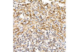 Immunohistochemistry of paraffin-embedded human spleen using BST2 Rabbit pAb (ABIN6129547, ABIN6137673, ABIN6137675 and ABIN6215924) at dilution of 1:100 (40x lens).