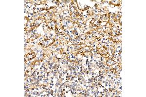 Immunohistochemistry of paraffin-embedded human spleen using BST2 Rabbit pAb (ABIN6129547, ABIN6137673, ABIN6137675 and ABIN6215924) at dilution of 1:100 (40x lens). (BST2 anticorps  (AA 49-161))