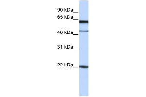 WB Suggested Anti-C6orf25 Antibody Titration:  0. (C6orf25 anticorps  (N-Term))