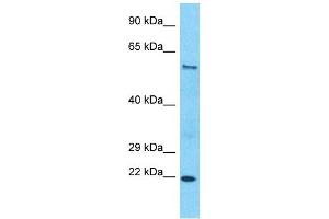 Host:  Rabbit  Target Name:  SLC43A2  Sample Type:  Esophagus Tumor lysates  Antibody Dilution:  1. (SLC43A2 anticorps  (Middle Region))