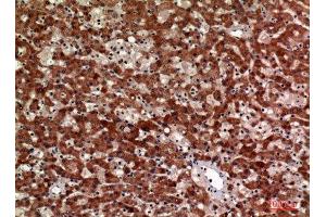 Immunohistochemistry (IHC) analysis of paraffin-embedded Human Liver, antibody was diluted at 1:100. (CD63 anticorps  (Internal Region))