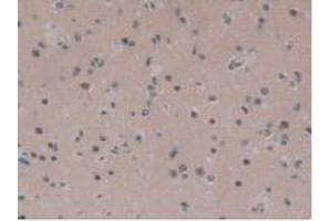 IHC-P analysis of Human Brain Tissue, with DAB staining. (IGFBPI anticorps  (AA 36-235))