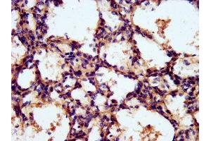 IHC image of ABIN7142118 diluted at 1:300 and staining in paraffin-embedded human lung tissue performed on a Leica BondTM system.