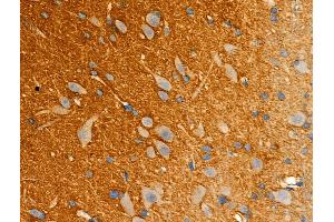 ABIN6261879 and ABIN6277946 at 1/100 staining Rat brain tissue by IHC-P.