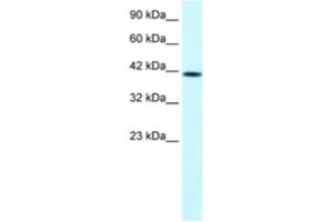 Western Blotting (WB) image for anti-PTK2B Protein tyrosine Kinase 2 beta (PTK2B) antibody (ABIN2460534) (PTK2B anticorps)
