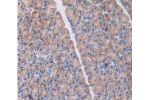 Used in DAB staining on fromalin fixed paraffin- embedded Kidney tissue