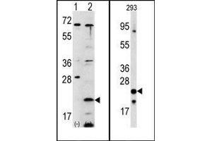 (LEFT)Western blot analysis of FXN (arrow) using rabbit polyclonal FXN Antibody (C-term). (Frataxin anticorps  (C-Term))