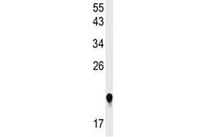 Western blot analysis of IMP3 antibody and HeLa lysate.