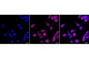 Immunocytochemical staining of HeLa cells with NDUFA13 antibody (ABIN7799542), 1:1,000).