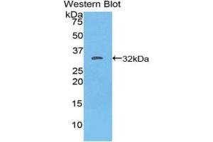 Western blot analysis of the recombinant protein. (CD103 anticorps  (AA 671-917))