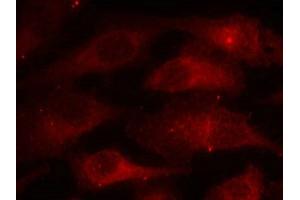 Immunofluorescence staining of methanol-fixed Hela cells using Caveolin-1(Phospho-Tyr14) Antibody.