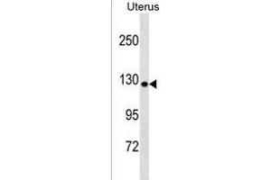 COL19A1 Antibody (N-term) (ABIN1539125 and ABIN2850306) western blot analysis in Uterus tissue lysates (35 μg/lane). (COL19A1 anticorps  (N-Term))